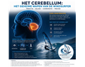 de rol van het cerebellum bij wave freestyle en slalomwindsurfen een neurofysiologische analyse binnen perception action coupling en het forward internal model